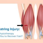 Hamstring Injury: How Physiotherapy Helps You to Recover Fast?