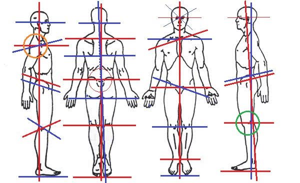 Best Posture Correction Physical Therapy Spacialist In Mumbai